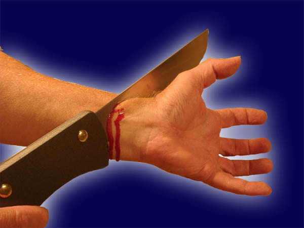 Messer durch Arm – Knife through Arm
